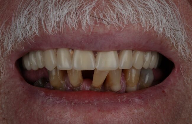 Before