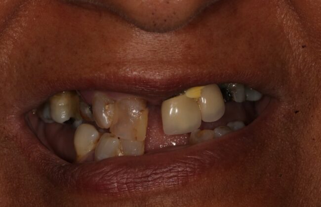 Before