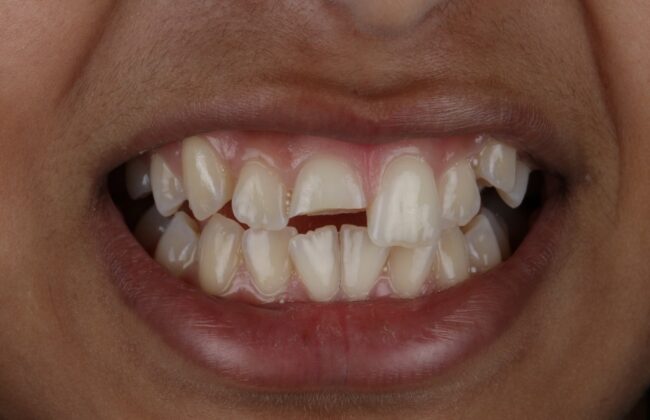 Before