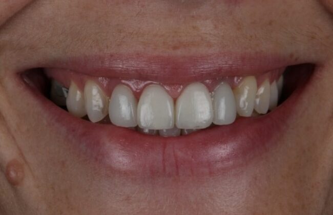 After