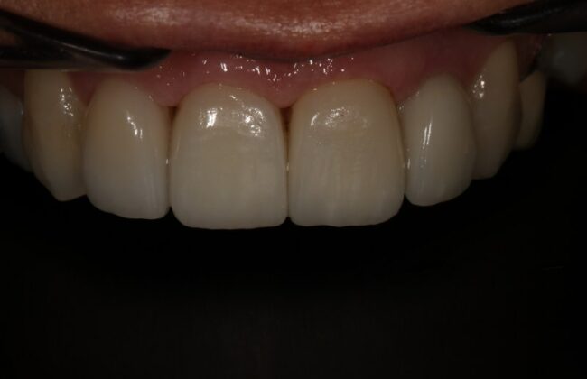 After