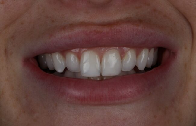 After