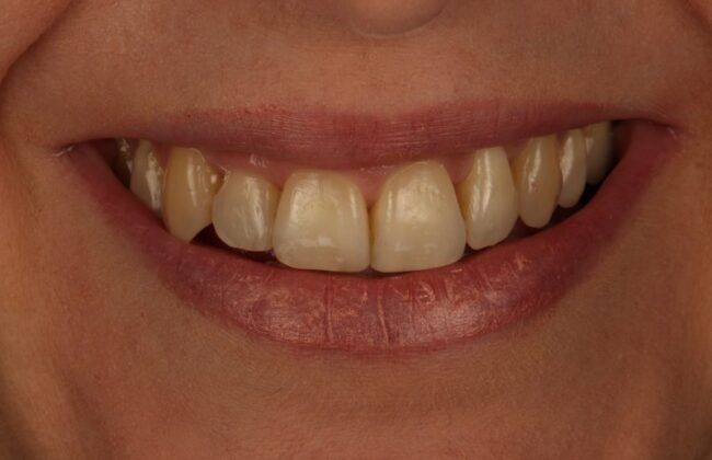 After