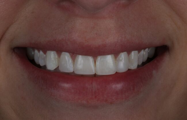 After