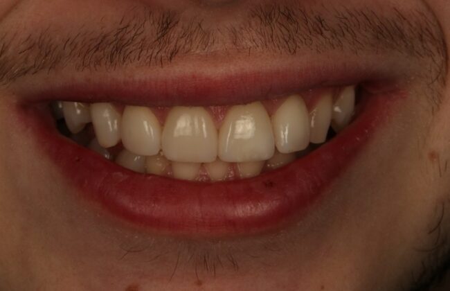 After