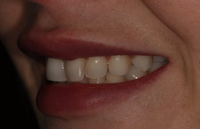 Before
