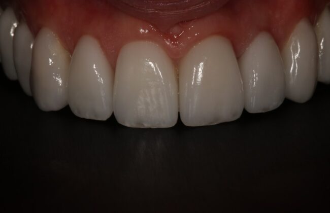 After