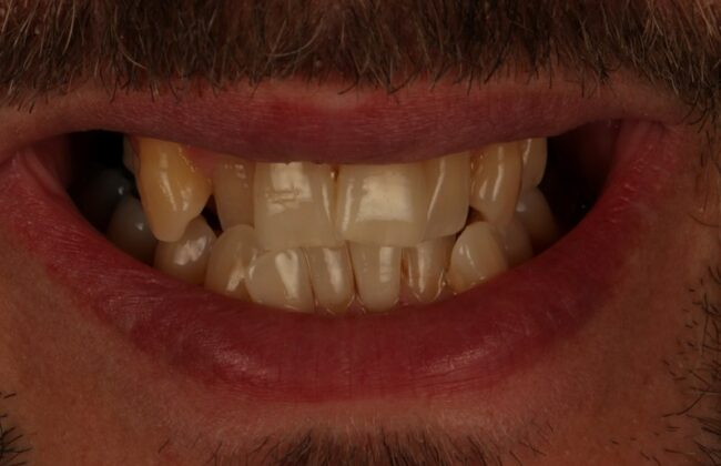 Before