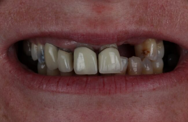 Before