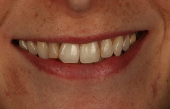 Before