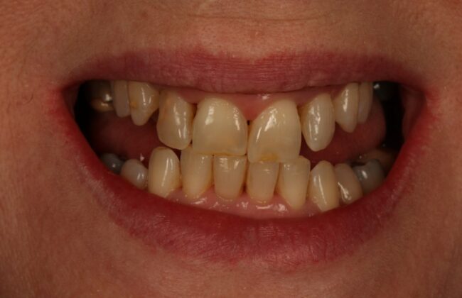 Before
