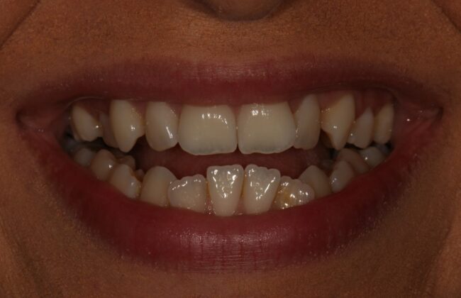 Before