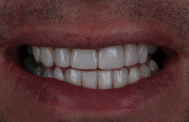 After