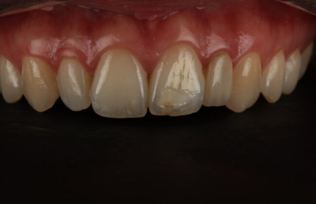 Before