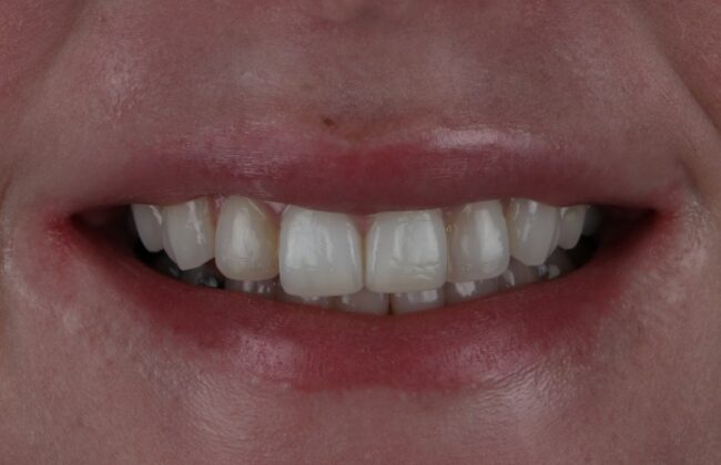 Before
