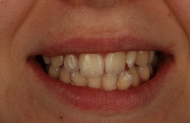 Before