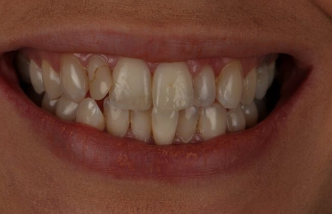 Before