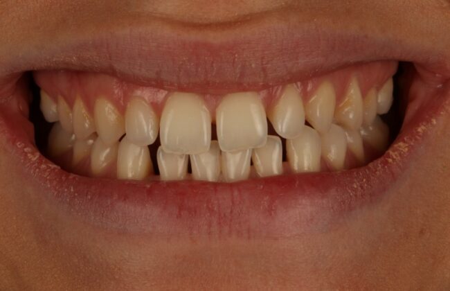 Before