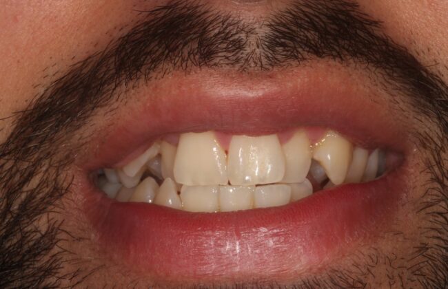 Before