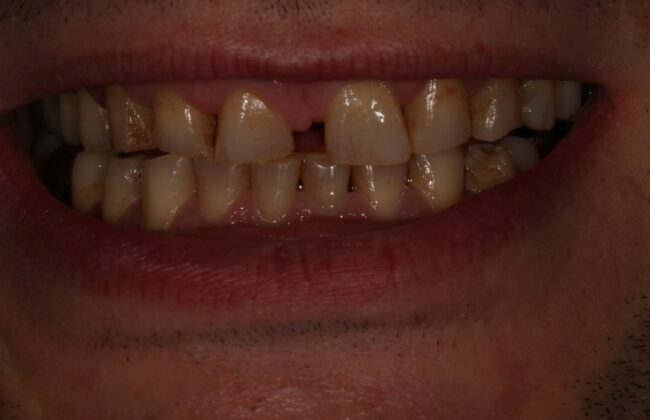 Before