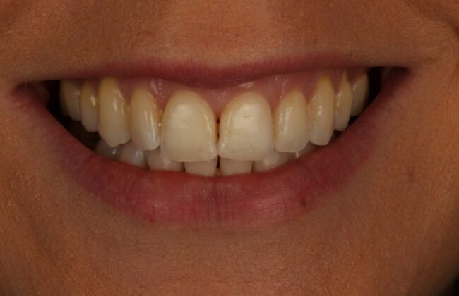 After