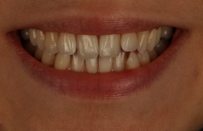 Before