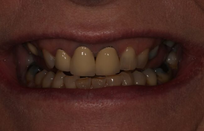 Before