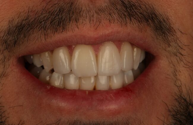 After