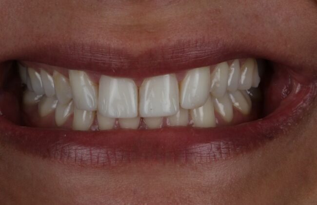 After