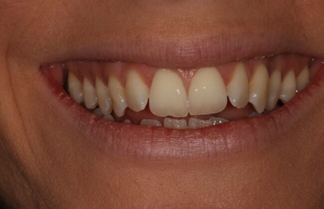 Before