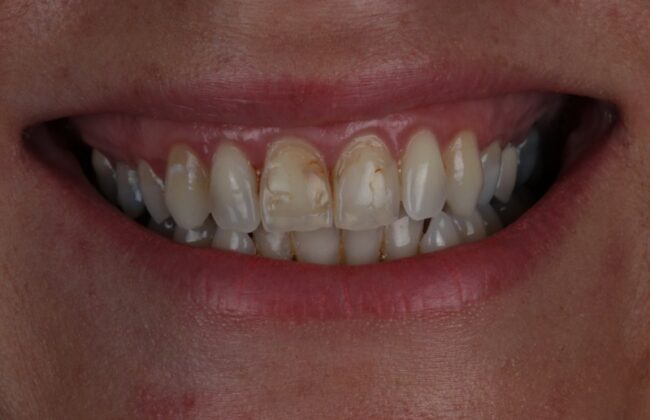 Before