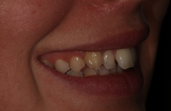 Before