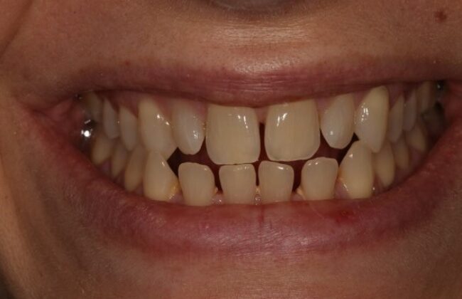 Before