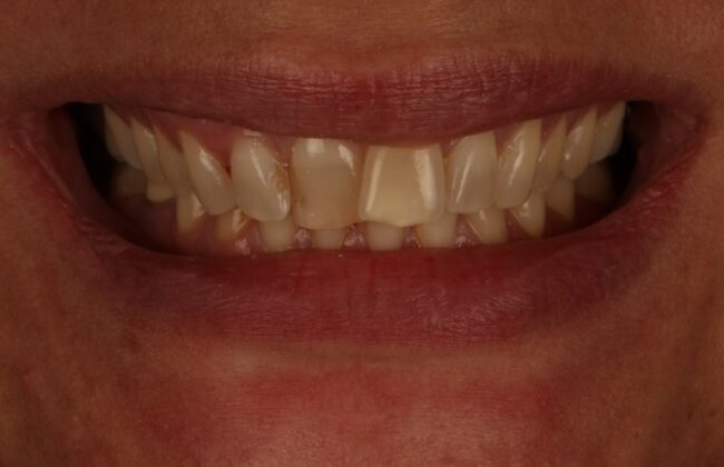 Before