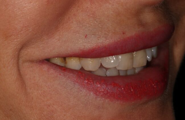 Before