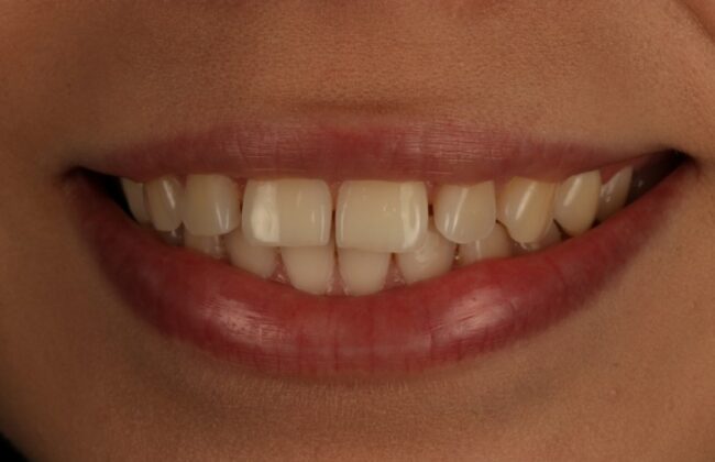 Before