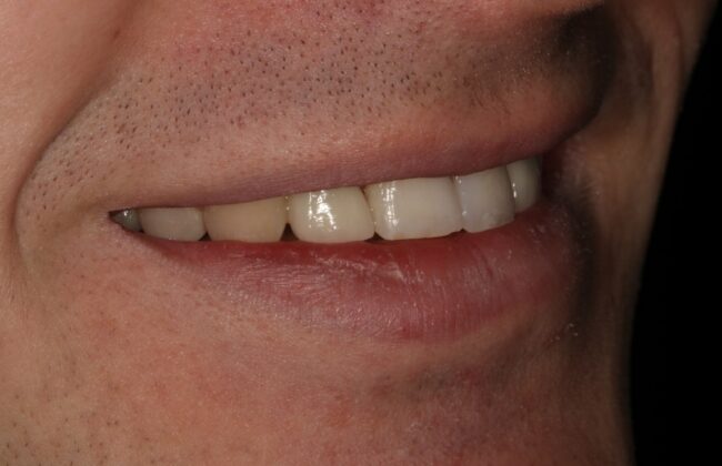 After
