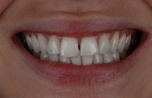 Before