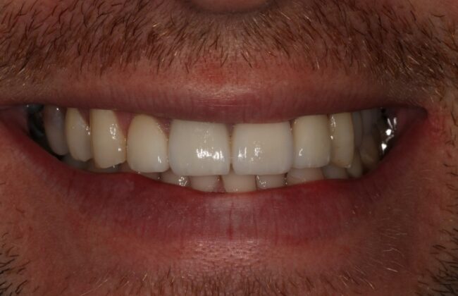 After