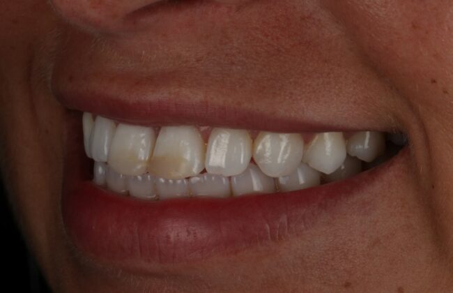 Before