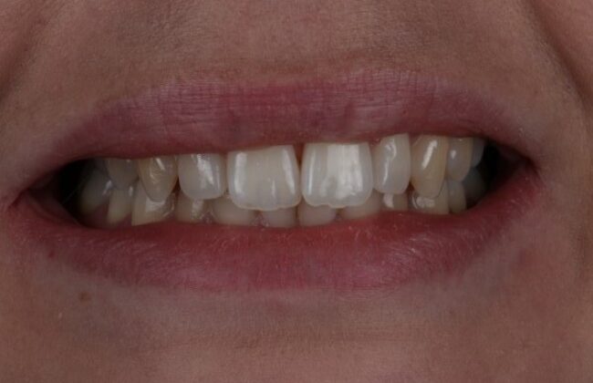 Before