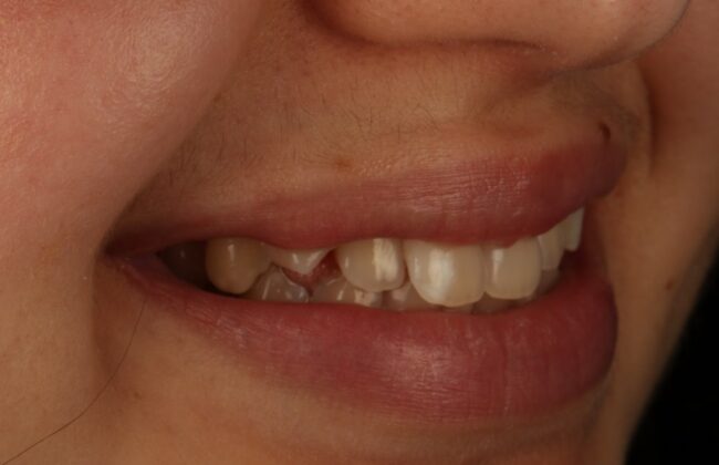 Before