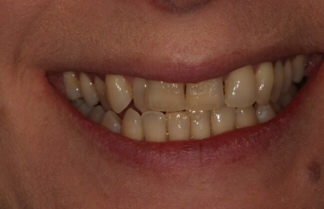 Before