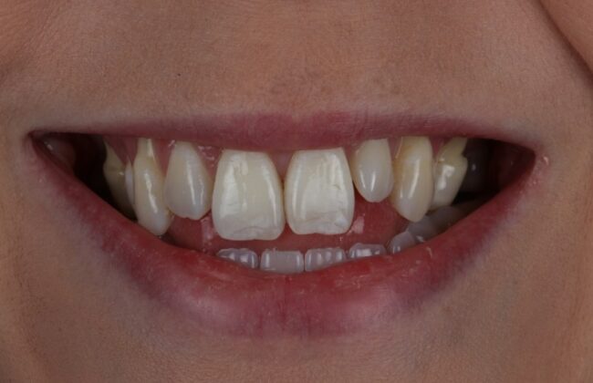 Before