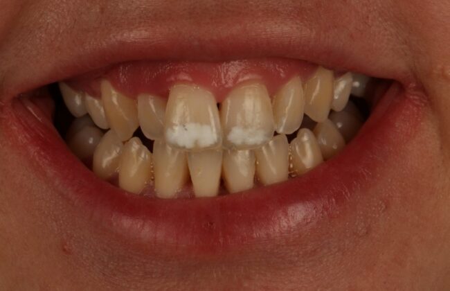 Before