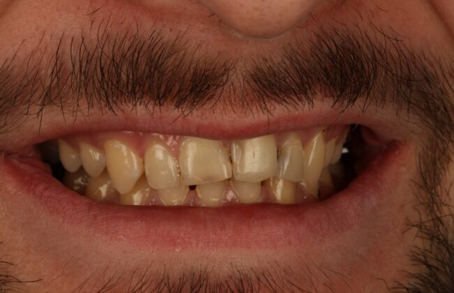 Before