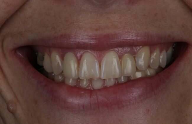 Before