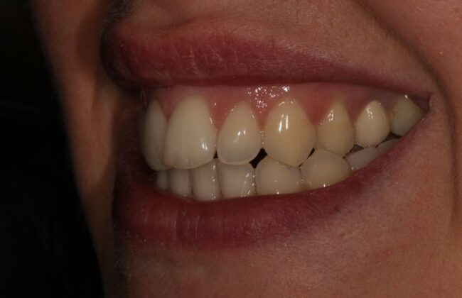 Before
