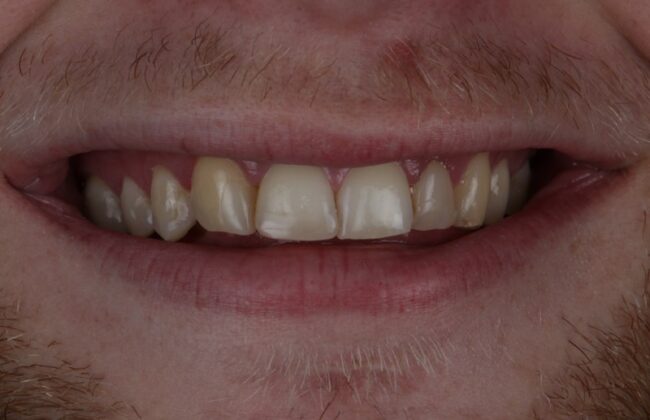 Before