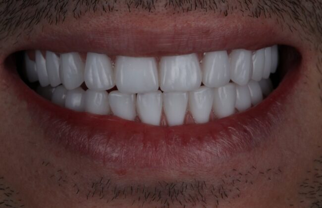 After